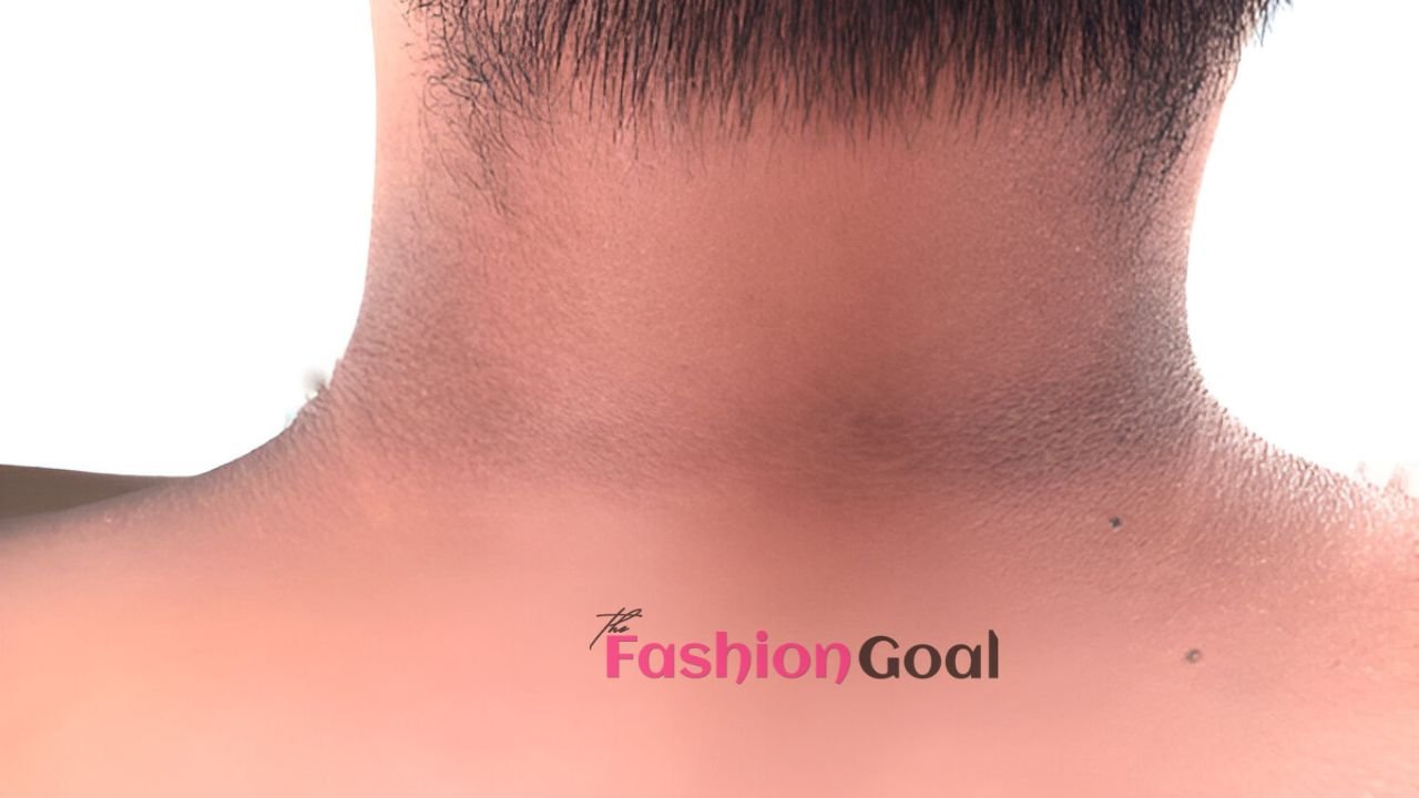 Dark Neck Discoloration : What Causes & How to Prevent It