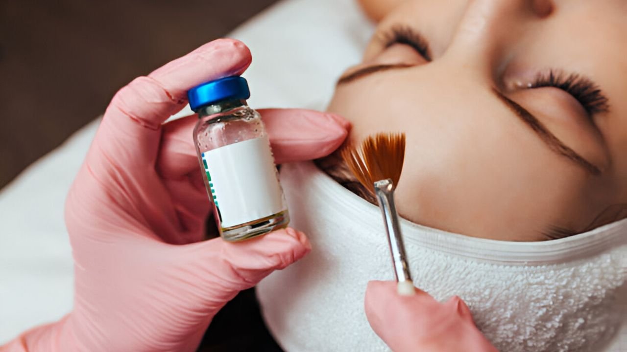 Chemical Peels vs. Microneedling: Which one Is Better for Wrinkles?
