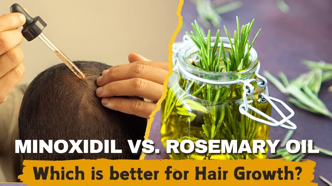 Minoxidil vs. Rosemary Oil: Which is better for Hair Growth?